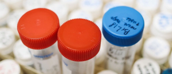 Genetische Diagnostik: Wann ein Test sinnvoll ist