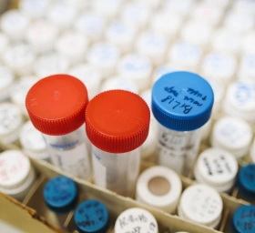 Genetische Diagnostik: Wann ein Test sinnvoll ist