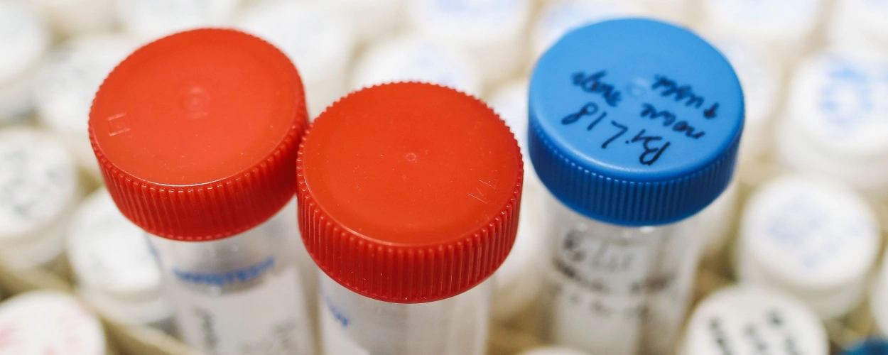 Genetische Diagnostik: Wann ein Test sinnvoll ist